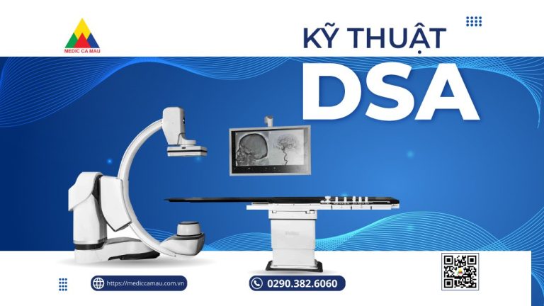 KỸ THUẬT DSA