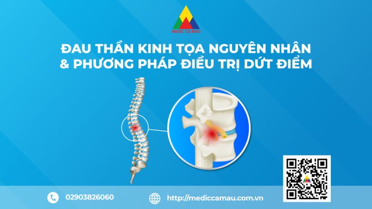 ĐAU THẦN KINH TỌA – NGUYÊN NHÂN & PHƯƠNG PHÁP ĐIỀU TRỊ DỨT ĐIỂM