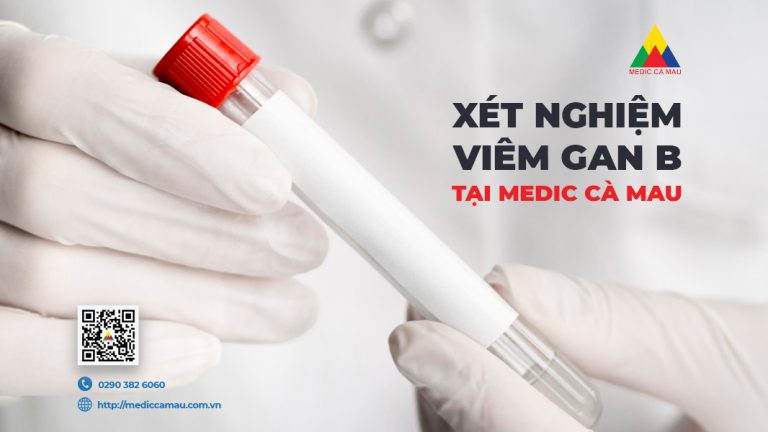 XÉT NGHIỆM VIÊM GAN B TẠI BỆNH VIỆN MEDIC CÀ MAU