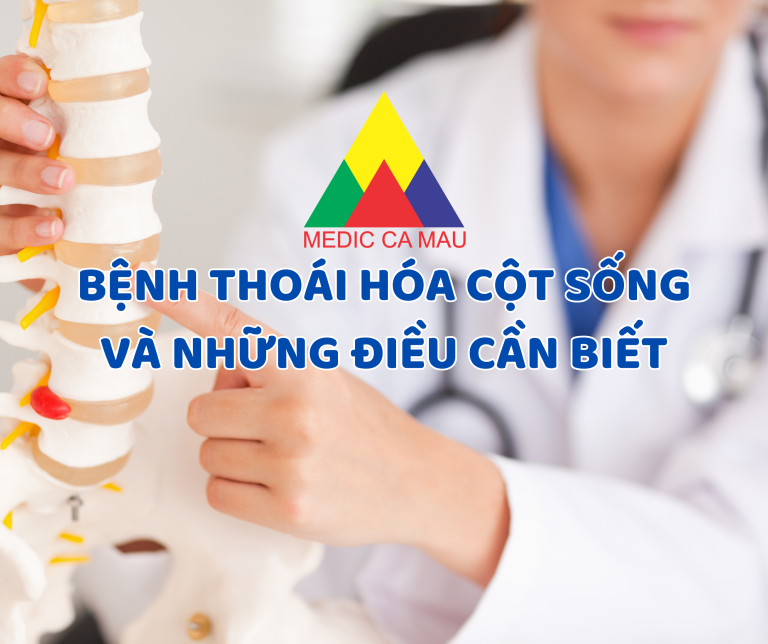 BỆNH THOÁI HÓA CỘT SỐNG VÀ NHỮNG ĐIỀU CẦN BIẾT