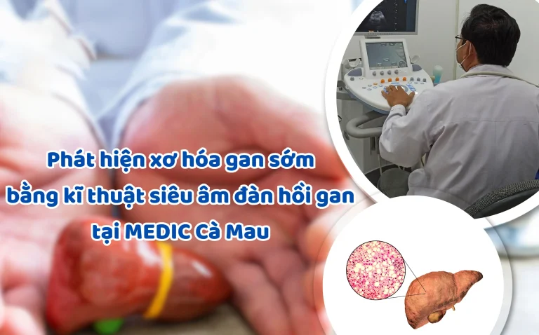 PHÁT HIỆN XƠ HÓA GAN BẰNG SIÊU ÂM ĐÀN HỒI GAN