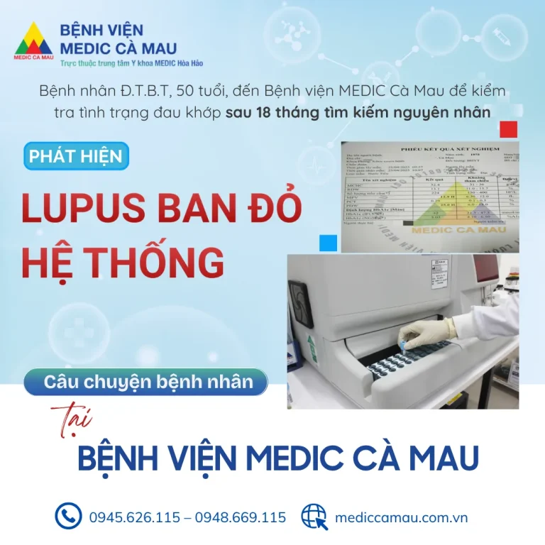 Lupus ban đỏ hệ thống: Khi đau khớp kéo dài không đơn thuần là viêm khớp