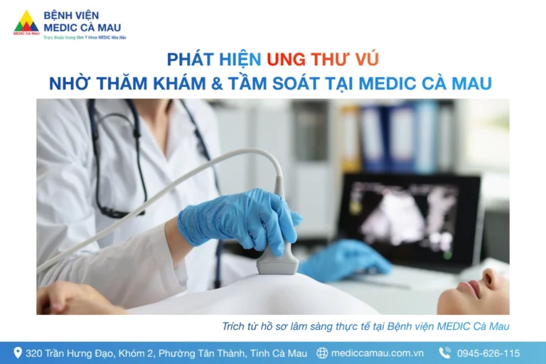 KHỐI U VÚ DI CĂN BỊ BỎ SÓT KHI TẦM SOÁT TẠI NHIỀU NƠI – ĐƯỢC PHÁT HIỆN KHI ĐẾN KIỂM TRA TẠI MEDIC CÀ MAU