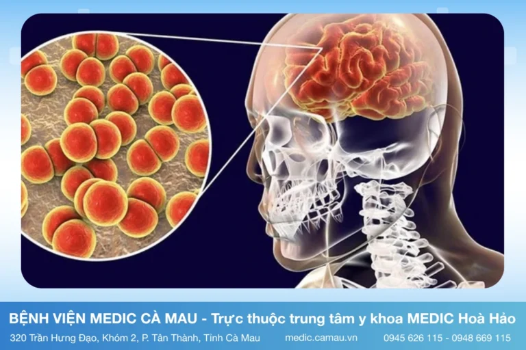 BỆNH VIÊM NÃO MÔ CẦU: MỐI NGUY HIỂM CẬN KỀ VÀ CÁCH PHÒNG NGỪA HIỆU QUẢ