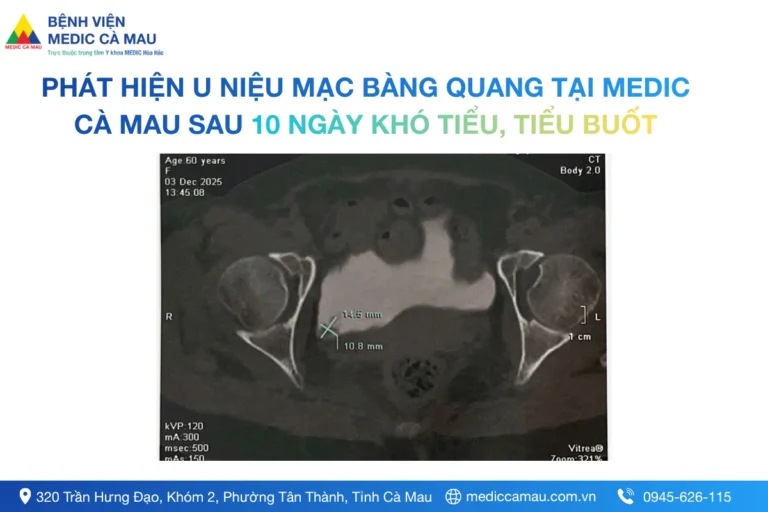 PHÁT HIỆN U NIỆU MẠC BÀNG QUANG TẠI MEDIC CÀ MAU SAU 10 NGÀY KHÓ TIỂU, TIỂU BUỐT