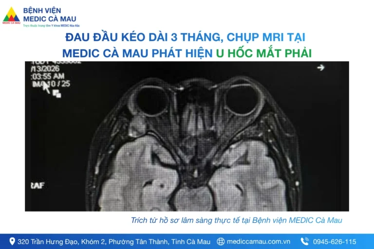 ĐAU ĐẦU KÉO DÀI 3 THÁNG, CHỤP MRI TẠI MEDIC CÀ MAU PHÁT HIỆN U HỐC MẮT PHẢI