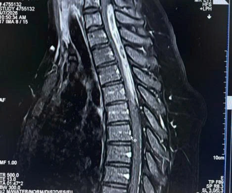 Hình ảnh trích từ hồ sơ lâm sàng thực tế tại MEDIC Cà Mau
