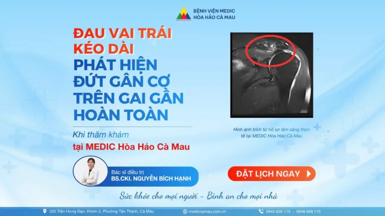 ĐAU VAI TRÁI KÉO DÀI – PHÁT HIỆN ĐỨT GÂN CƠ TRÊN GAI GẦN HOÀN TOÀN
